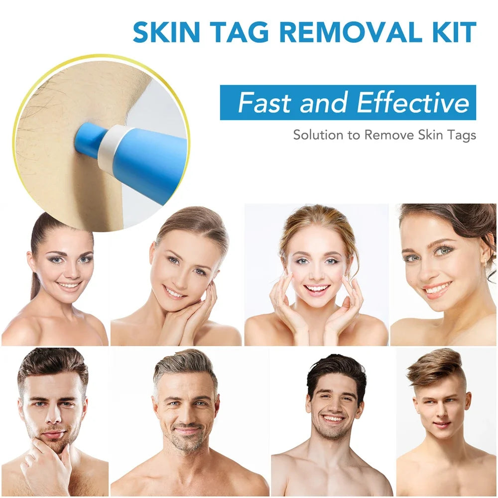 2-IN-1 Auto Micro Skin Tag Remover Kit