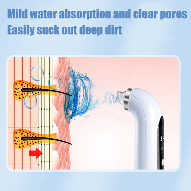 Blackhead Remover Pore Vacuum Face Cleaner: