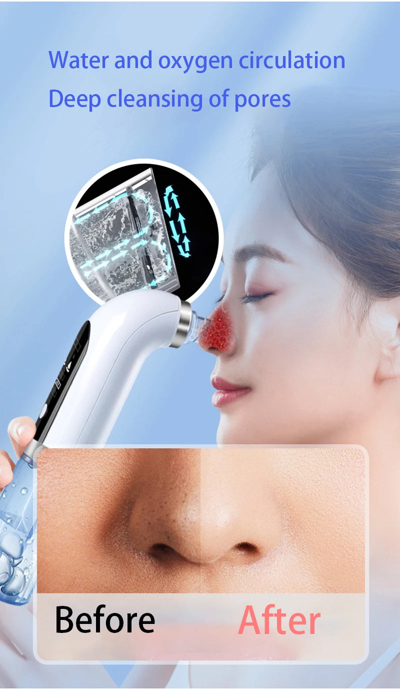 Blackhead Remover Pore Vacuum Face Cleaner: