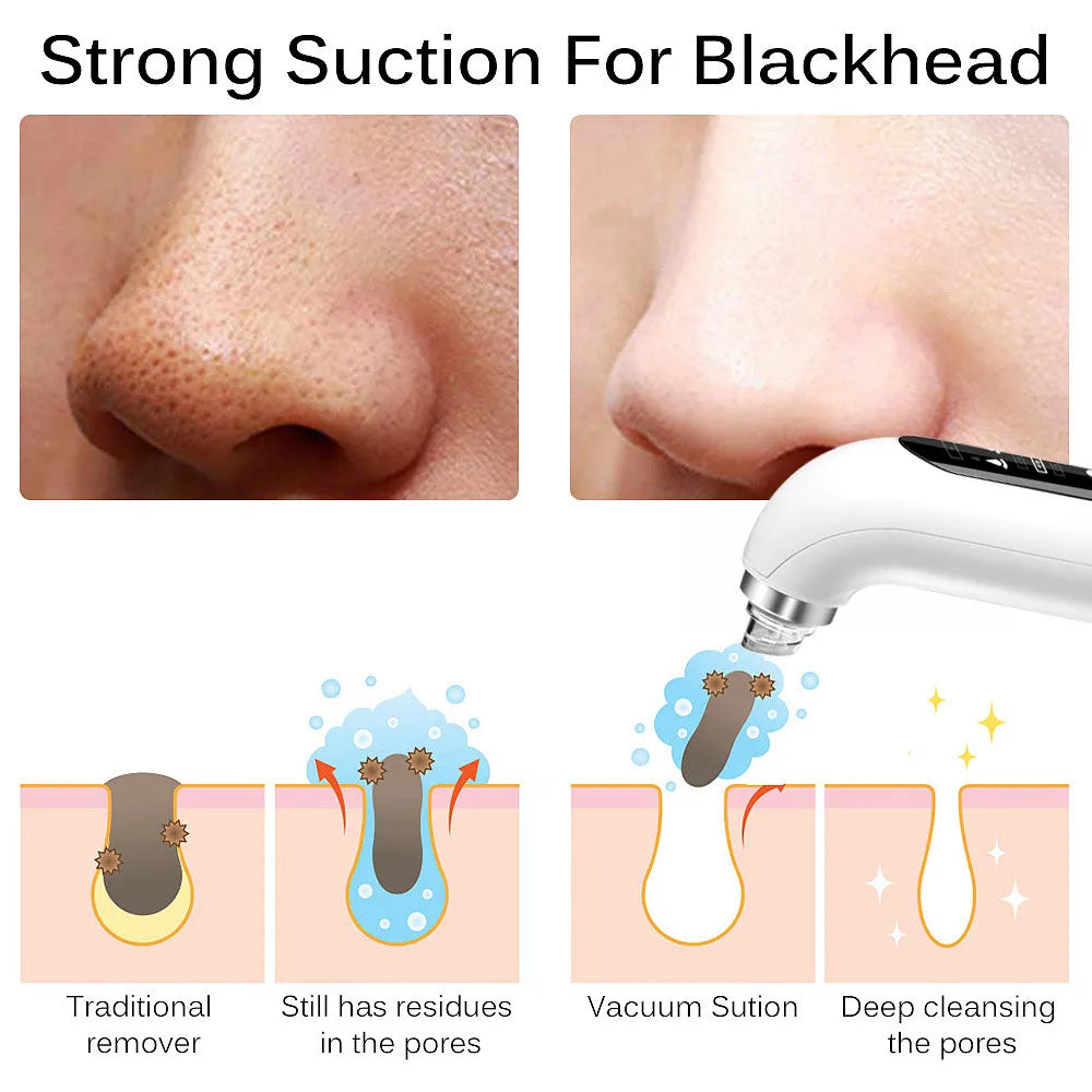 Blackhead Remover Pore Vacuum Face Cleaner: