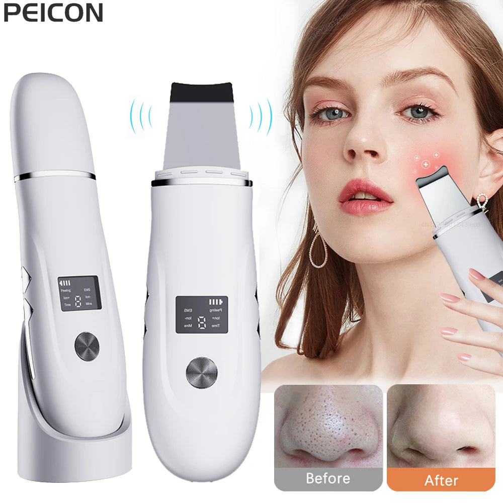 Ultrasonic Face Scrubber Facial Peeling Skin Scrubber Deep Facial Cleaning Spatula Acne Pore Ultrasonic Scrubber Facial Cleanser