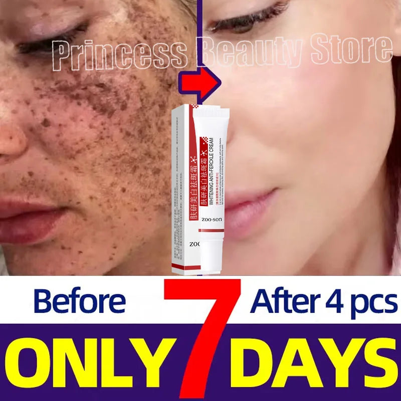 Powerful Spot-Removing Whitening Cream: