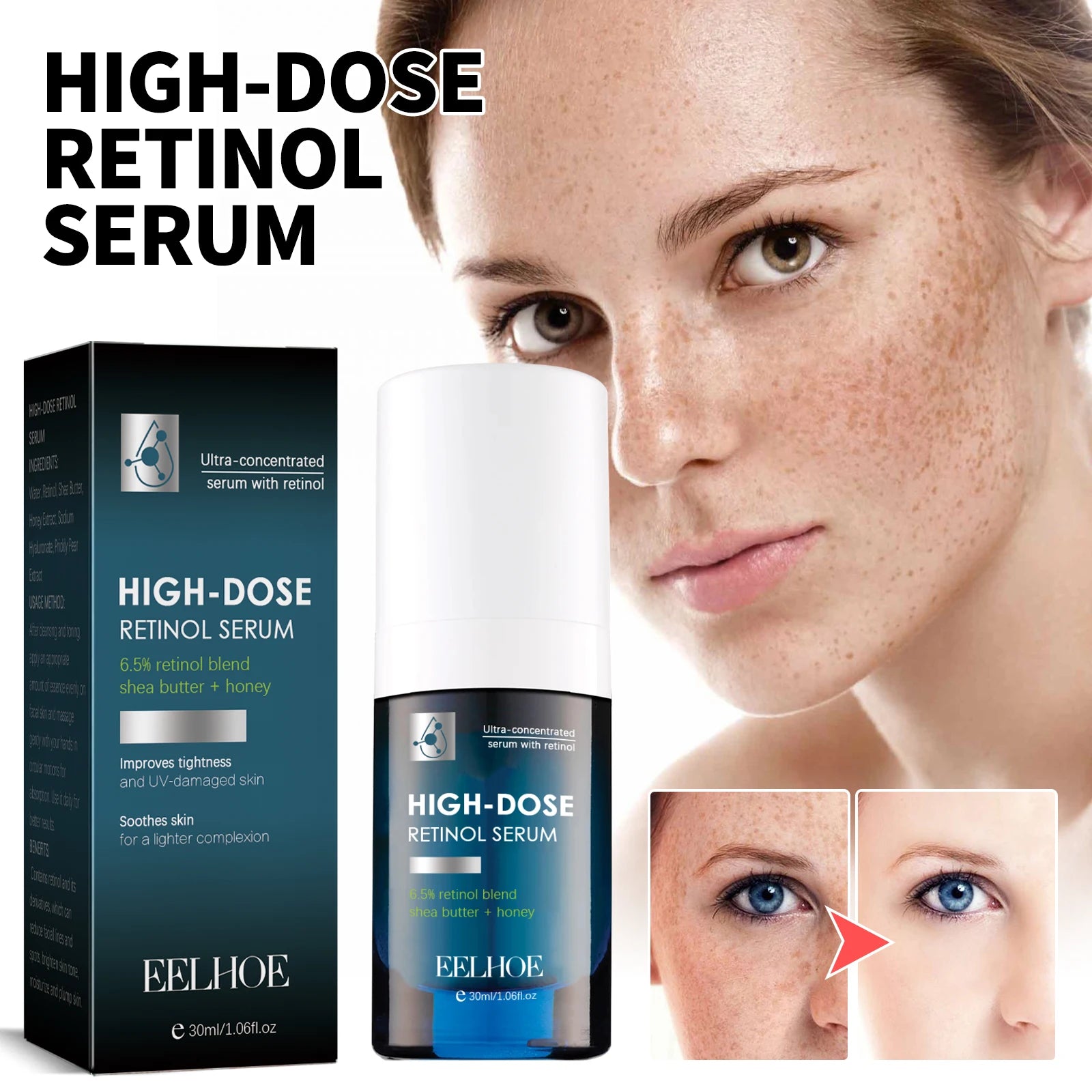 Retinol Face Serum – Dark Spot Remover & Hydrating Skin Care Essence