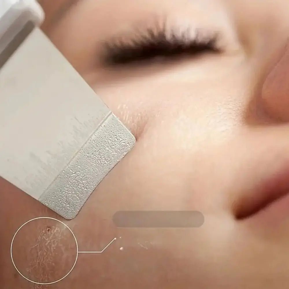 Ultrasonic Skin Scraper Pore Cleaning Machine: