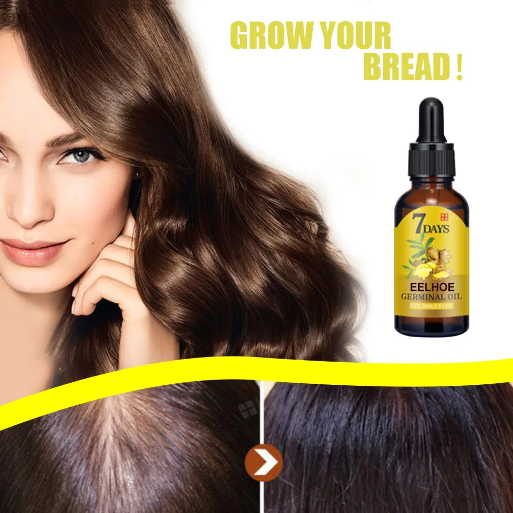 EELHOE Ginger Hair Growth Oil