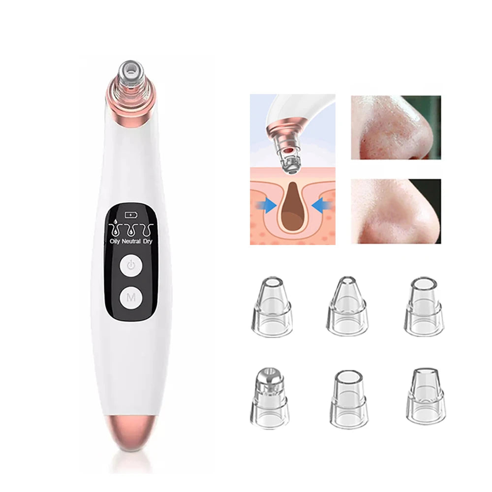 Blackhead Remover Pore Vacuum Face Cleaner: