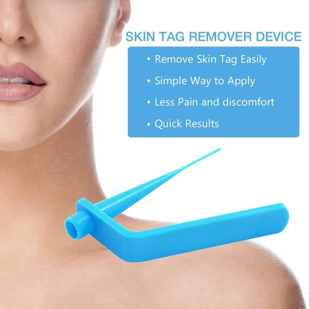 Skin Tag Removal Kit - Safe & Effective Micro Band Treatment Set