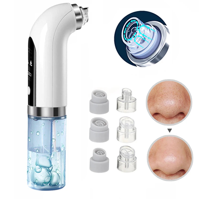 Blackhead Remover Pore Vacuum Face Cleaner: