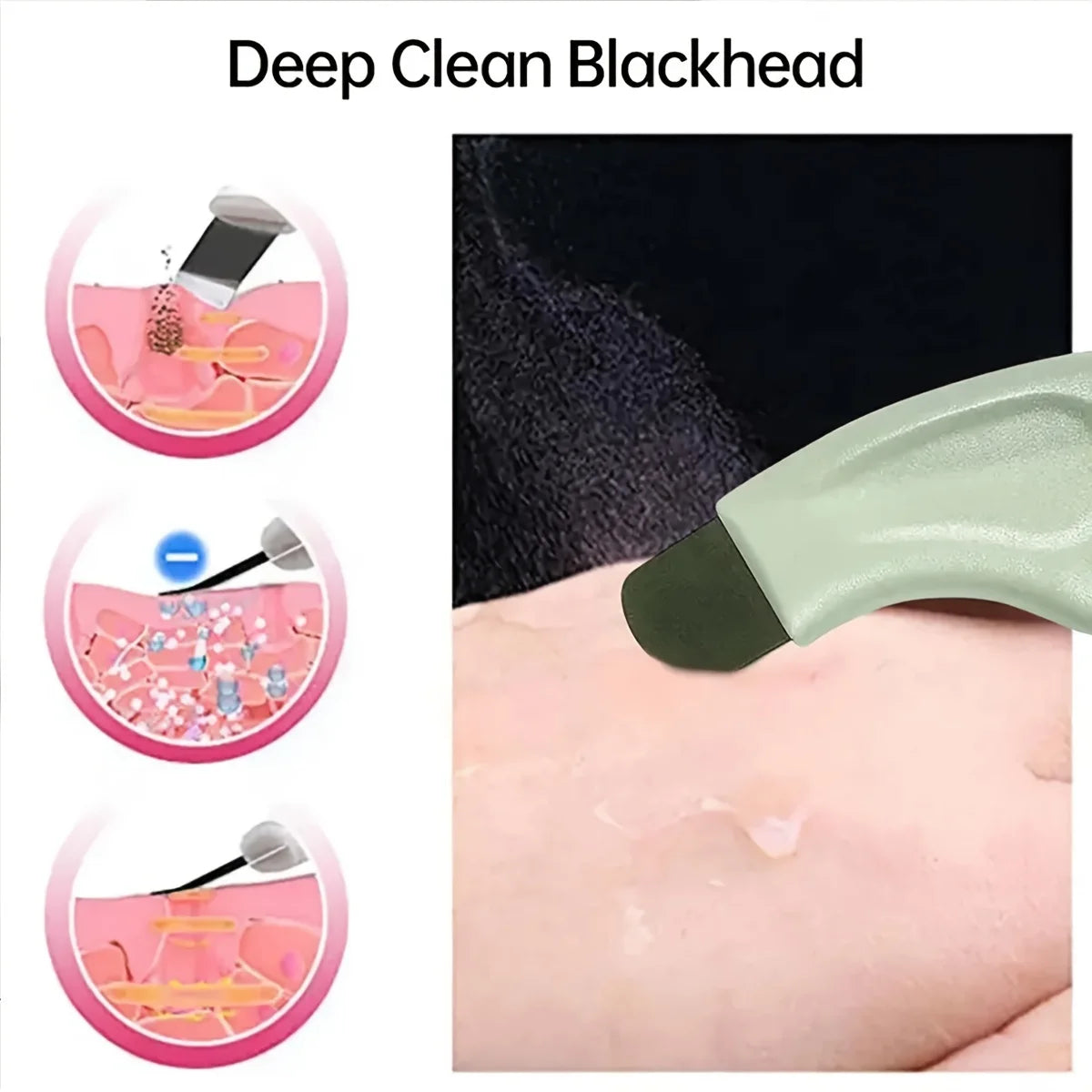 Facial Blackhead Removal Tool