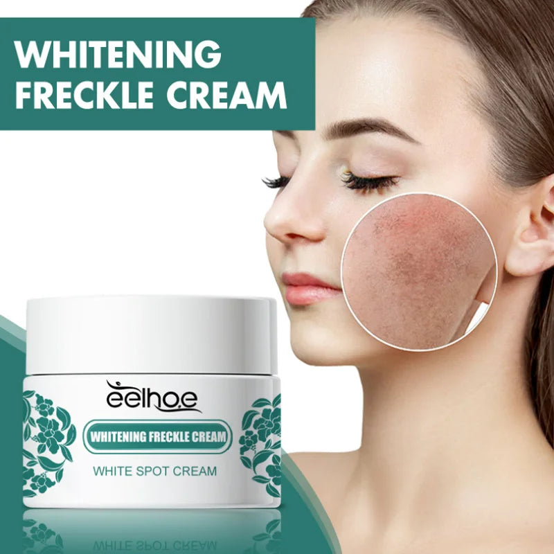 Niacinamide Whitening Freckle Cream Remove Dark Spot Melasma Pigmentation Brightening Cream Fade Stain Melanin Repair Skin Care