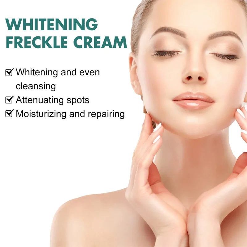 Niacinamide Whitening Freckle Cream Remove Dark Spot Melasma Pigmentation Brightening Cream Fade Stain Melanin Repair Skin Care