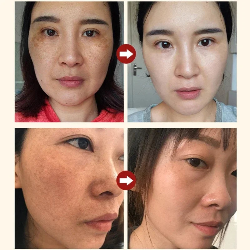 Niacinamide Facial Serum with Salicylic Acid - Moisturizing Skin Care