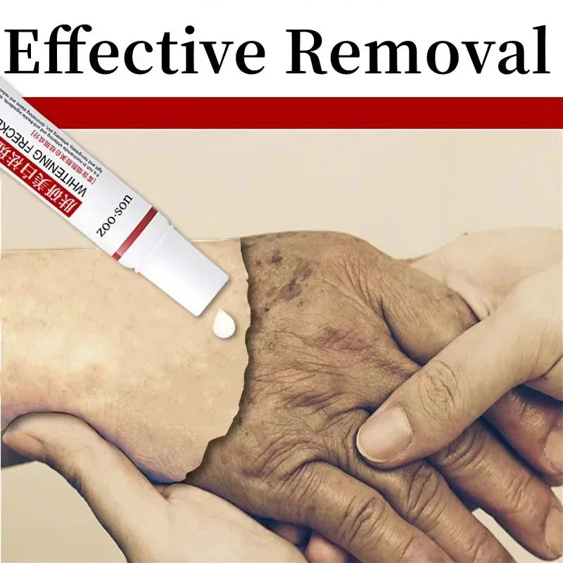 Powerful Spot-Removing Whitening Cream Beauty Gel: