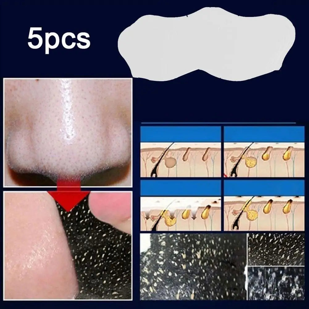 Nose Blackhead Remover Strips