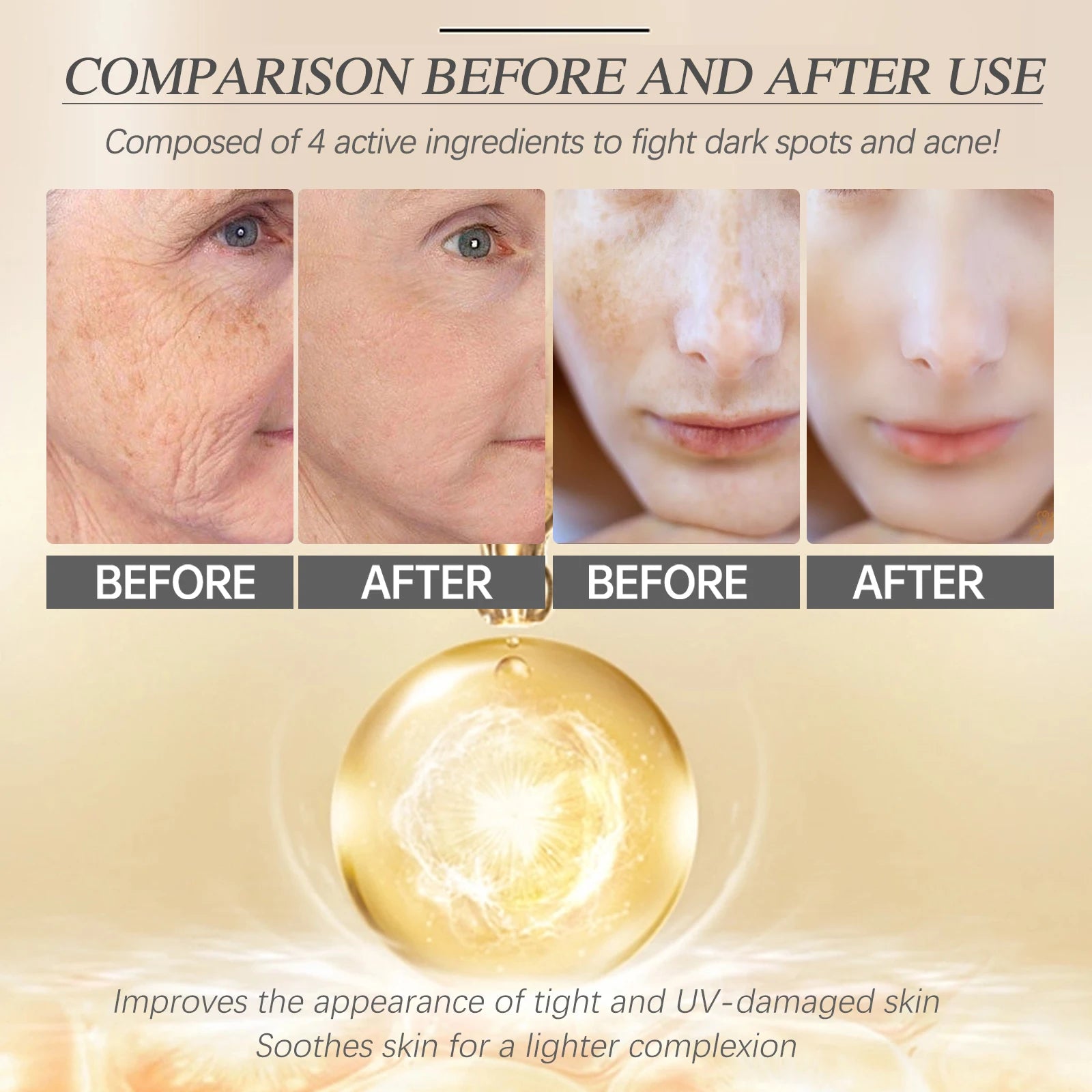 Retinol Face Serum – Dark Spot Remover & Hydrating Skin Care Essence