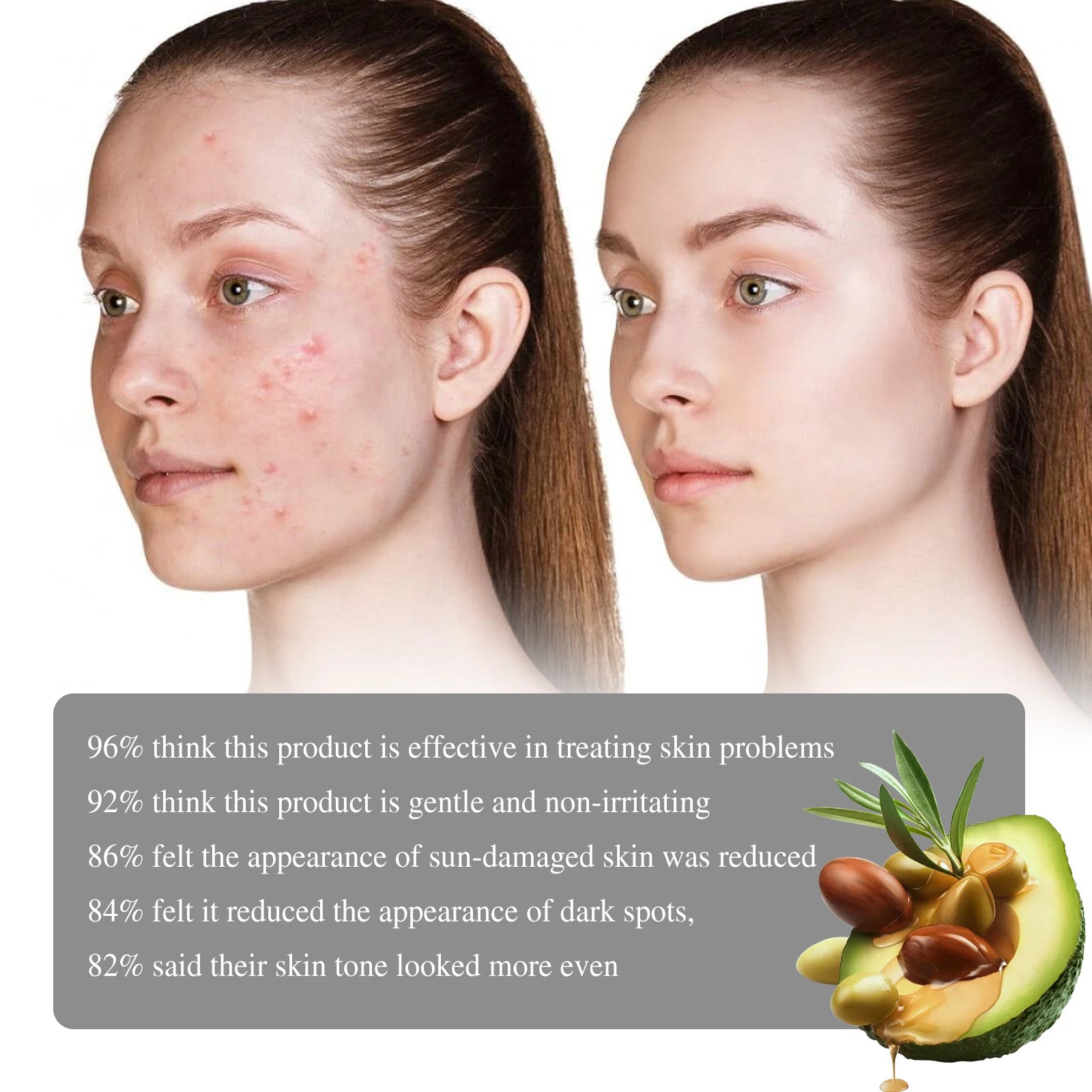Retinol Face Serum – Dark Spot Remover & Hydrating Skin Care Essence
