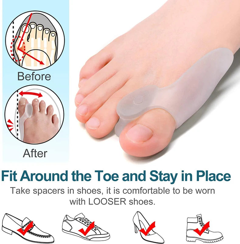 Say Goodbye to Bunion Discomfort with the 2pcs Soft Big Toe Corrector!