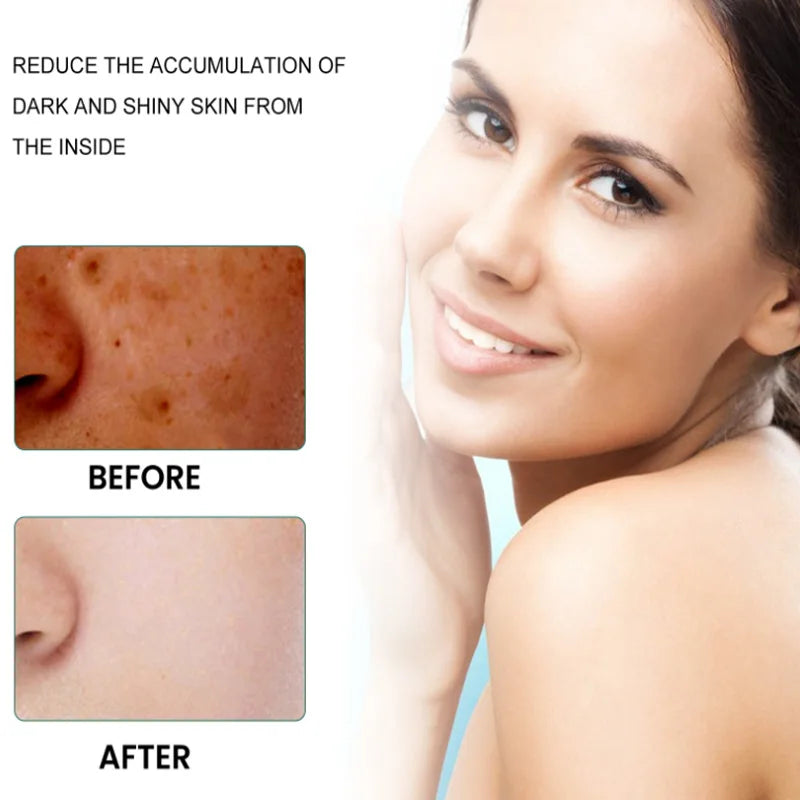 Niacinamide Whitening Freckle Cream Remove Dark Spot Melasma Pigmentation Brightening Cream Fade Stain Melanin Repair Skin Care