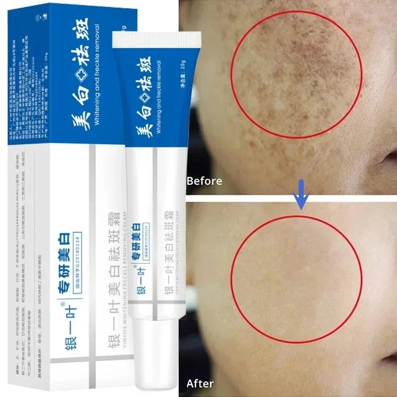 Whitening Blemish Cream