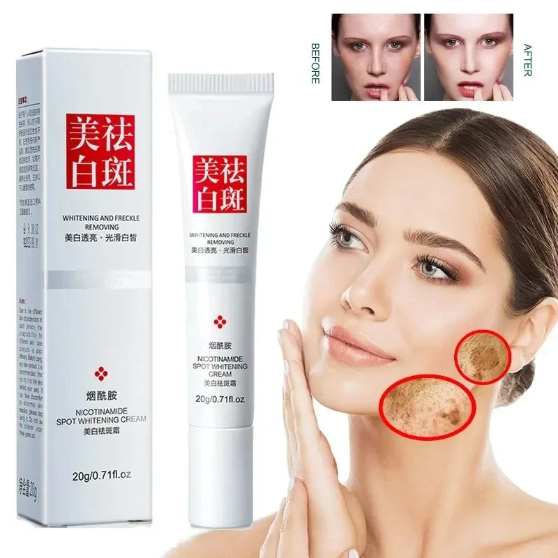 Fades Freckle & Dark Spots Face Cream: