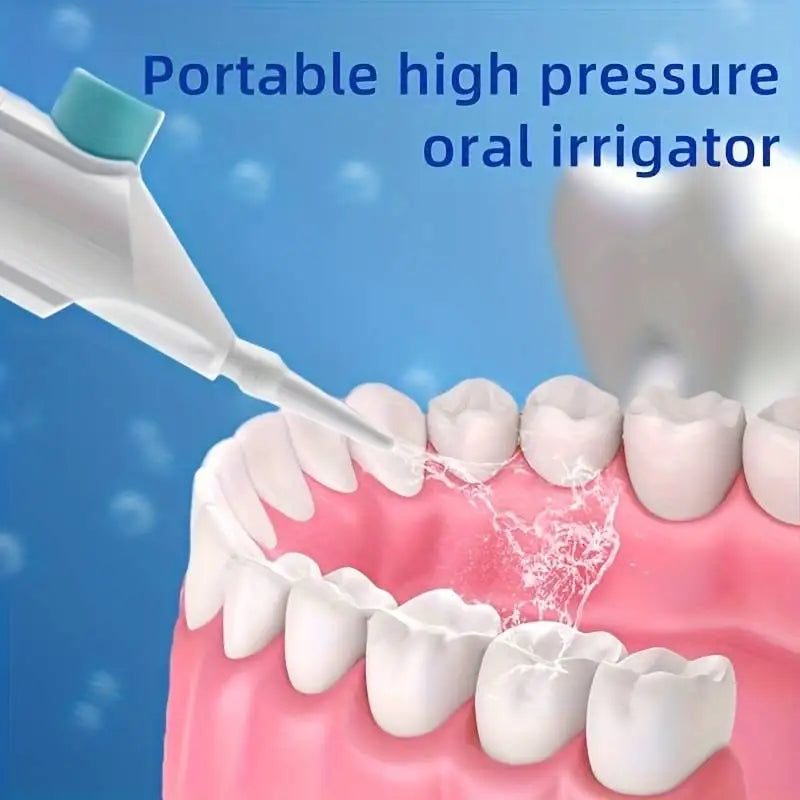 Household High-Pressure Oral Irrigator: