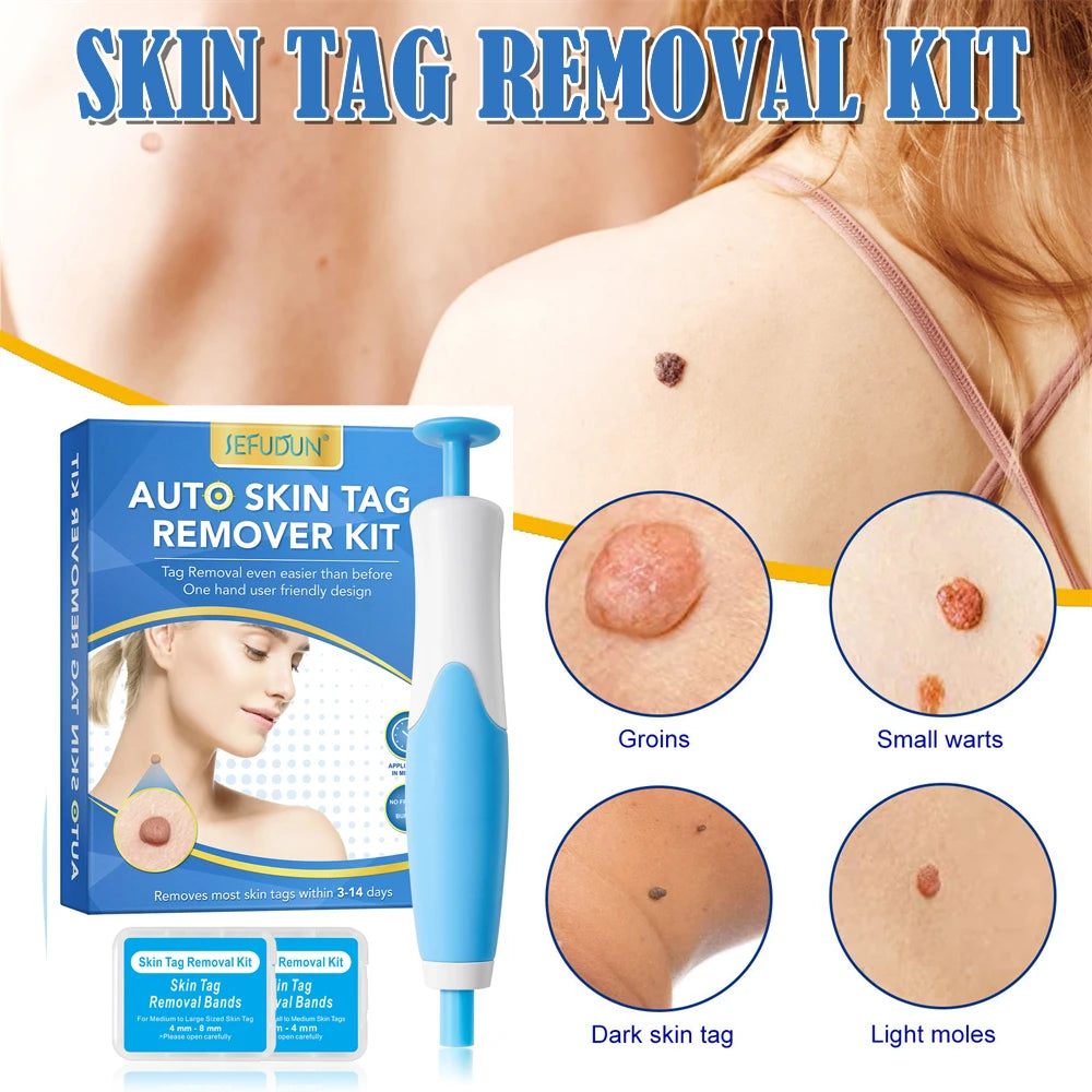 2-IN-1 Auto Micro Skin Tag Remover Kit