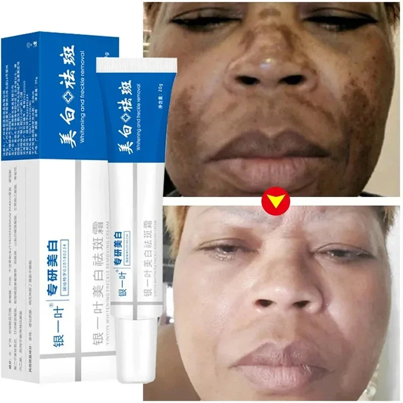 Whitening Blemish Cream