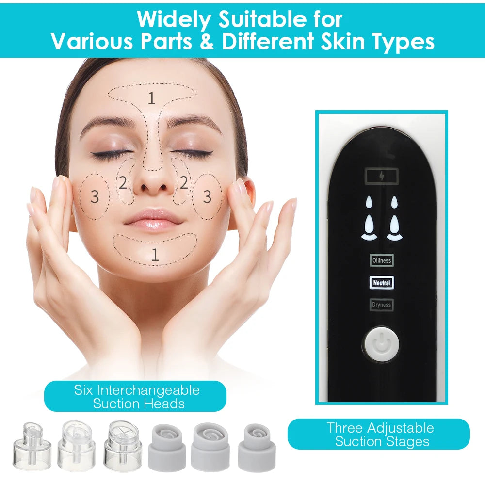 Blackhead Remover Pore Vacuum Face Cleaner: