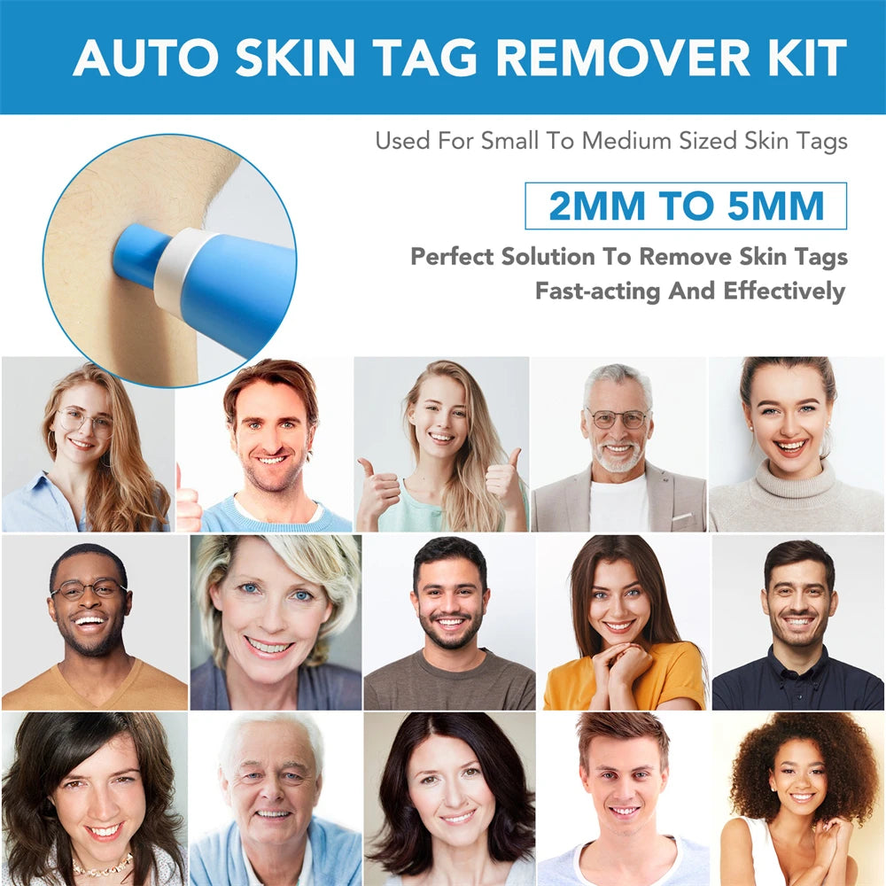 2-IN-1 Auto Micro Skin Tag Remover Kit