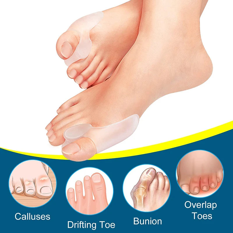 Say Goodbye to Bunion Discomfort with the 2pcs Soft Big Toe Corrector!